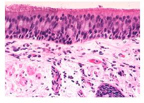 Pseudostratified columnar epithelium micrograph