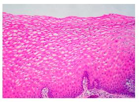 Stratified squamous epithelium micrograph