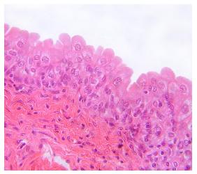 Transitional epithelium micrograph