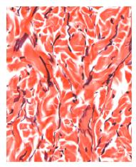 Dense irregular connective tissue