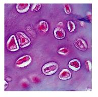 Hyaline cartilage
