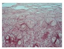 Elastic cartilage