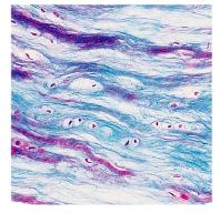 Fibrocartilage