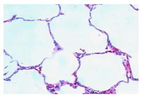 Simple squamous epithelium micrograph