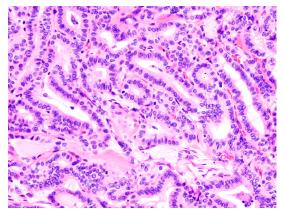Simple cuboidal epithelium micrograph