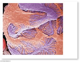 Podocytes and glomerular capillary filtration slits