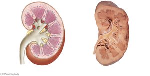 Frontal section through the left kidney showing major structures