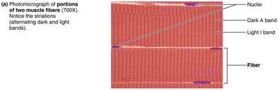 Photomicrograph of muscle fibers showing striations