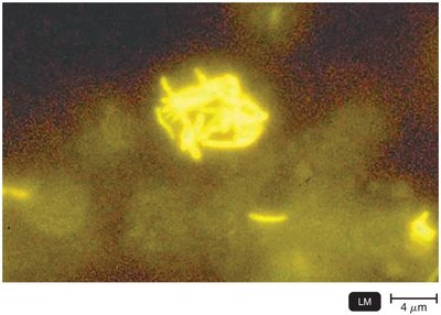 Fluorescence microscopy image
