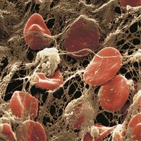 Erythrocytes trapped in a fibrin mesh