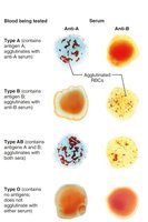 Blood typing of ABO blood types