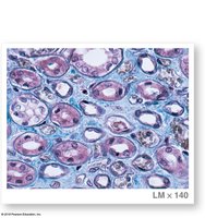 Micrograph of section through nephron loops and collecting ducts