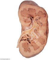 Frontal section of a human kidney