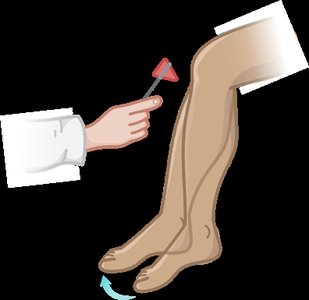Knee-jerk reflex test