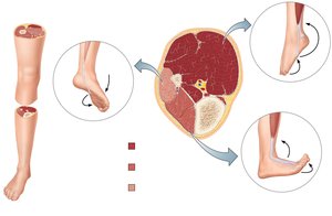 Muscle compartments of the leg