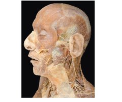 Cadaver dissection of facial muscles
