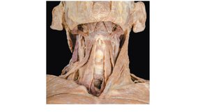 Suprahyoid and infrahyoid muscles, cadaver dissection