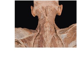 Deep back muscles, superficial layer, cadaver dissection