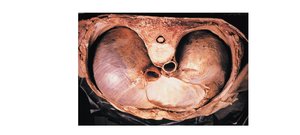 Diaphragm, superior view