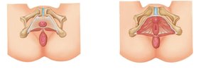 Muscles of the perineum