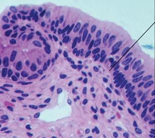 Stratified columnar epithelium