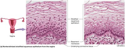 Nonkeratinized stratified squamous epithelium