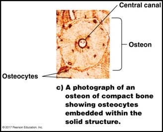 Section of bone showing osteons, compact and spongy bone