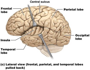 Lateral view with lobes pulled back to show insula