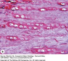 Chondrocytes in fibrocartilage