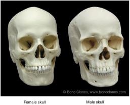 Comparison of female and male skulls
