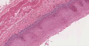 Stratified squamous epithelium