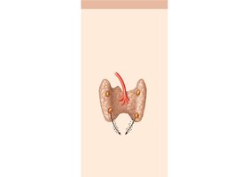 Humoral stimulus: Low Ca2+ stimulates PTH release