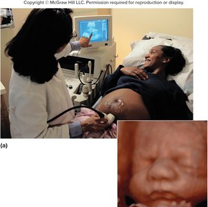 Sonography in obstetrics
