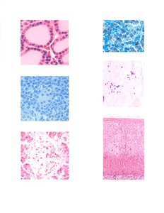 Microscopic images of endocrine glands