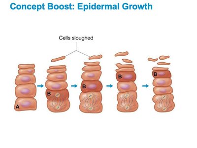 Diagram of sweat glands and sebaceous glands