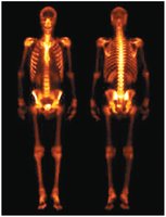 Medical imaging using radioisotopes