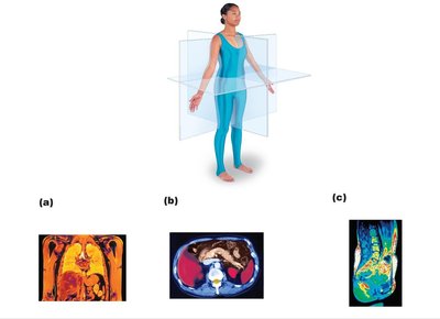 Body planes and MRI scans