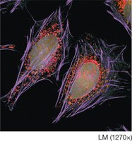 Microfilaments in the cytoskeleton