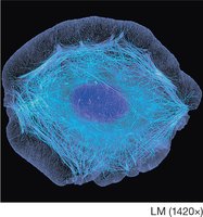 Microtubules in the cytoskeleton