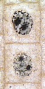 Prophase in onion root tip