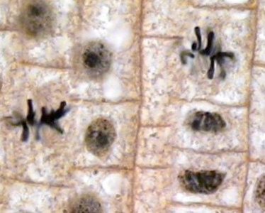 Metaphase in onion root tip