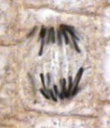 Anaphase in onion root tip