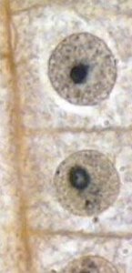 Interphase in onion root tip