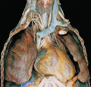 Human cadaver showing thoracic organs