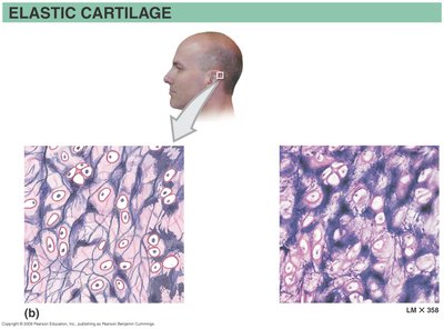 Fibrocartilage micrograph and location