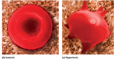 Effects of isotonic and hypertonic solutions on RBCs