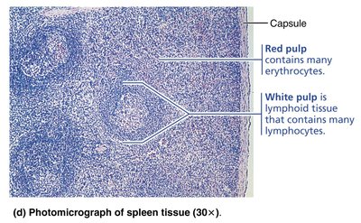 Photomicrograph of spleen tissue