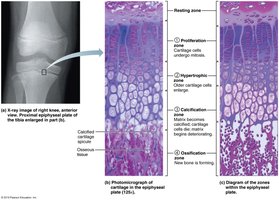 Growth zones in the epiphyseal plate