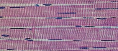 Skeletal muscle fiber histology