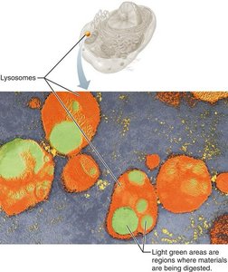 Electron micrograph of lysosomes